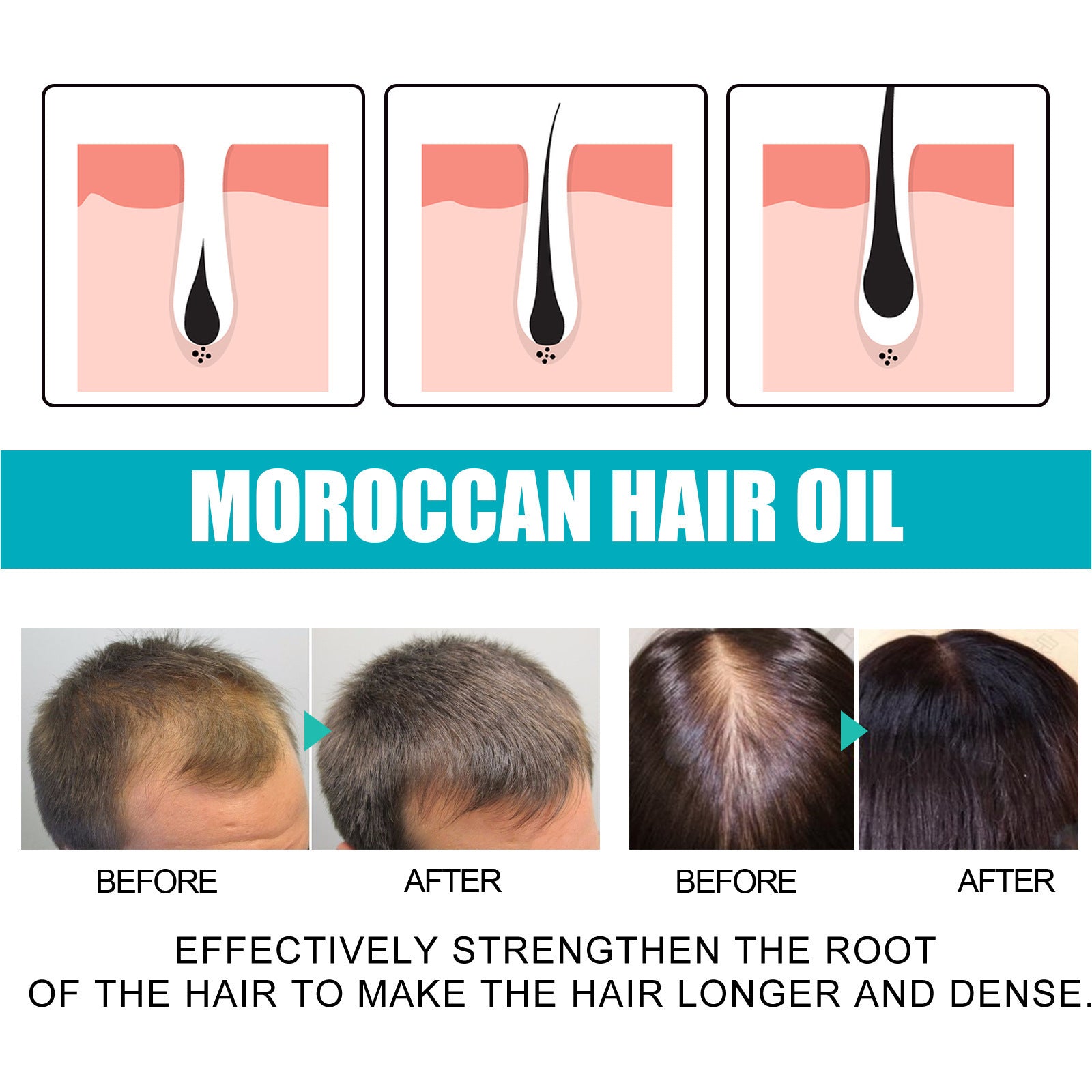 Morocco Hair Care Essential Oil Smooth Manic Dry And Dense Hair
