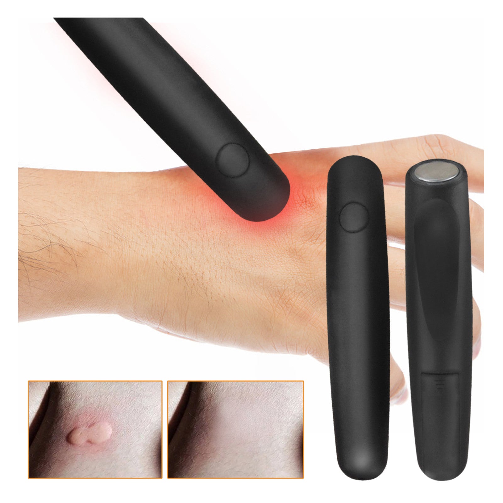 Anti-itching Stick Portable Anti-insect Lightweight Black Anti-itching Heat-sensitive Pen