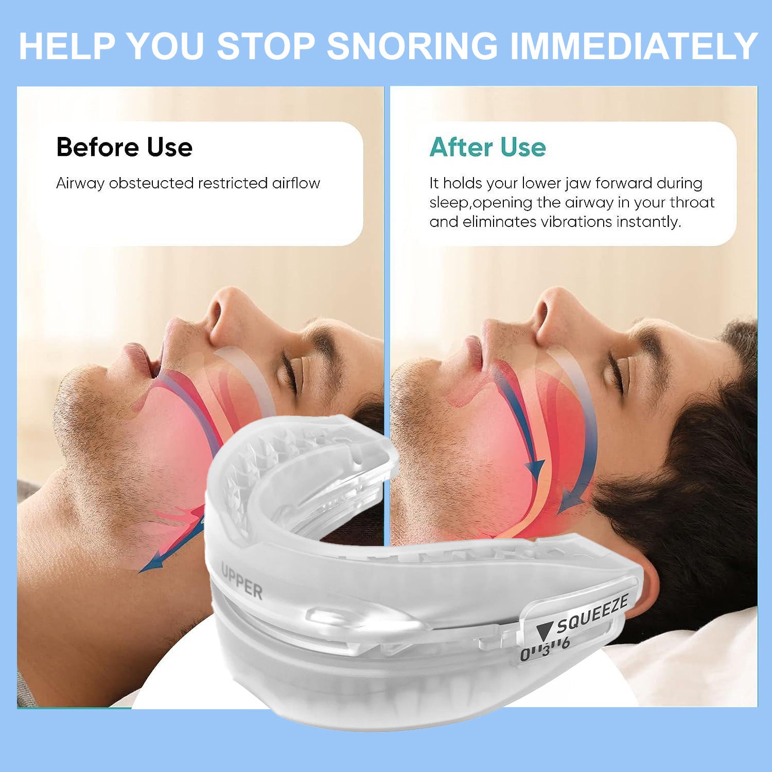 Three-gear Adjustable Hot Melt To Prevent Molars