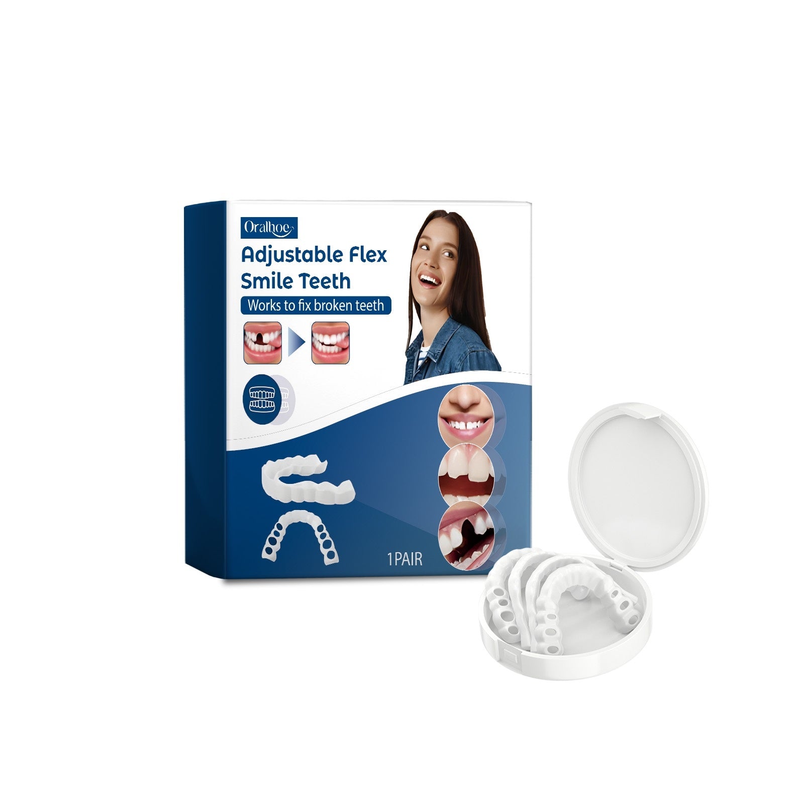 Adjustable Snap On Dentures