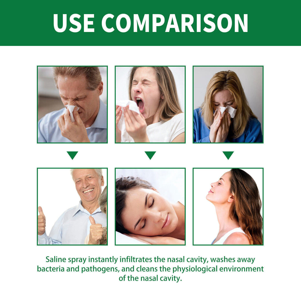 Nasal Discomfort Clean The Nasal Cavity Body Care Spray