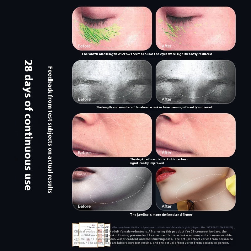 Beauty Instrument Household Color Light EMS Lifting Skin Rejuvenation Massage Cleaning 6-in-1