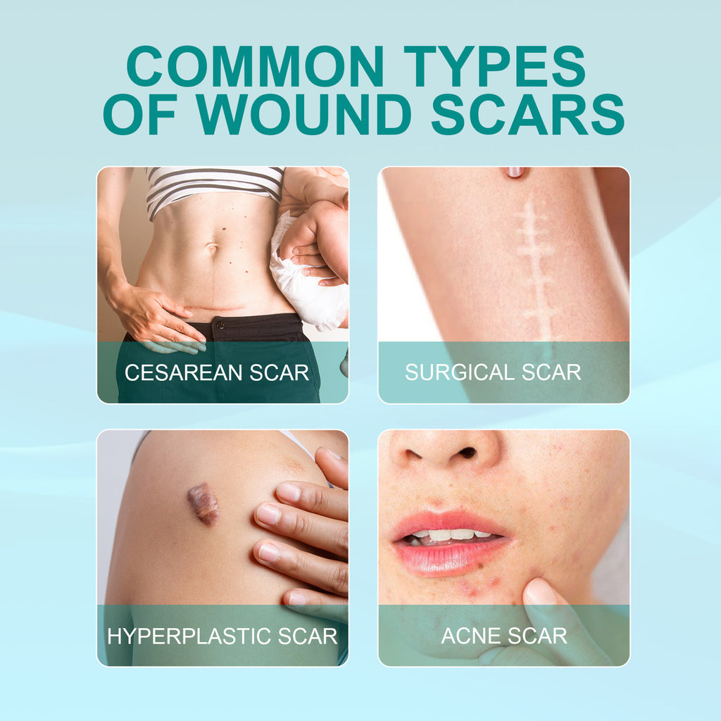 Surgical Scar Smoothing Skin Care Spray