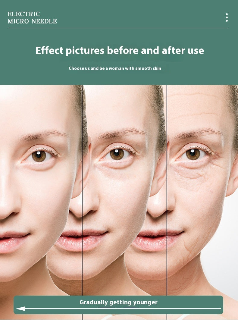 Portable Manual Lanury Roller Stamp Microneedle