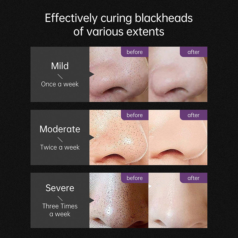 Blackhead Removing Nose Cream T Area Care Clean Shrink Pores Mask