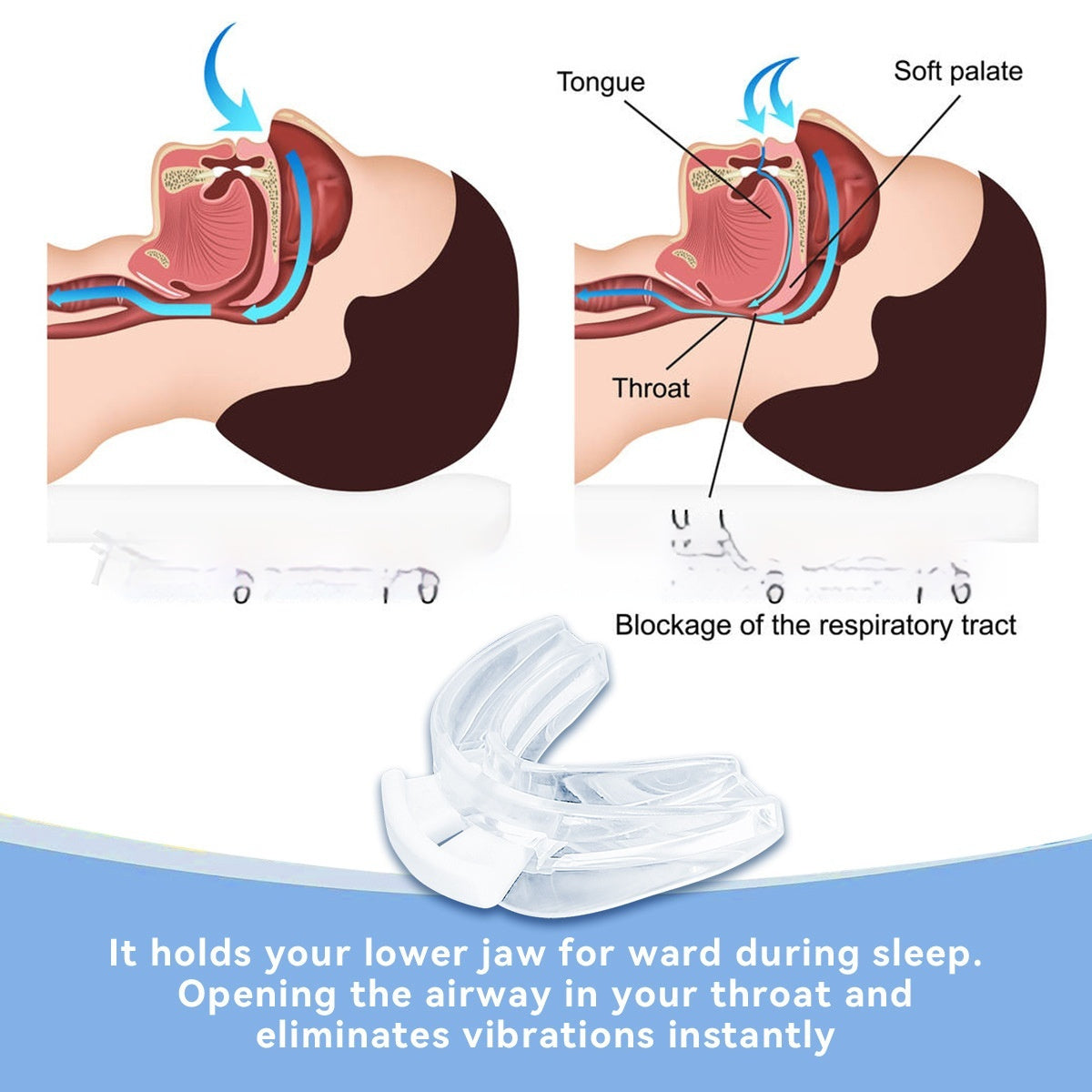 Night Anti-snoring Multifunctional Thermoforming Eva Tooth Socket
