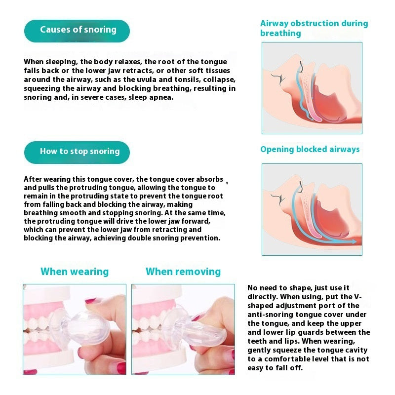 Anti-snoring Device Tongue Case Silicone Anti-snoring Respirator Sleeping Aid Instrument Resistance